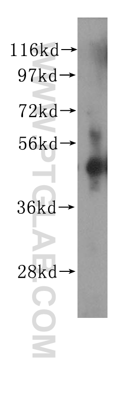 11282-1-AP;human spleen tissue