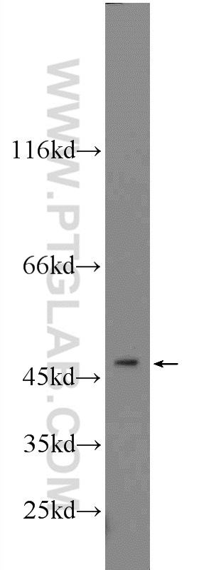 23799-1-AP;mouse pancreas tissue