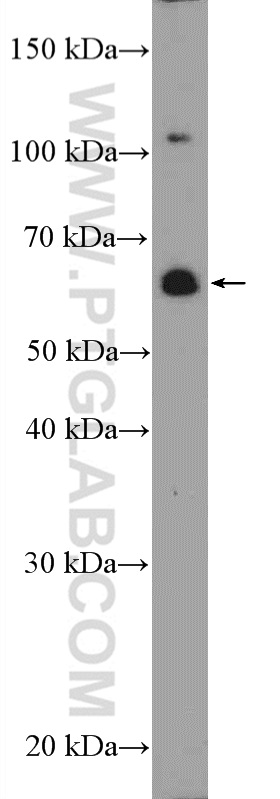 20799-1-AP;PC-3 cells