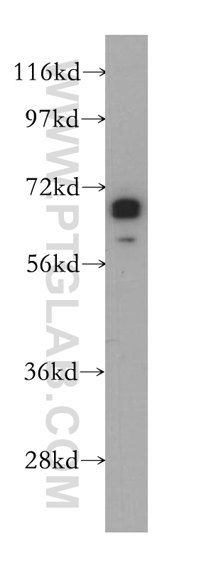 14529-1-AP;mouse brain tissue