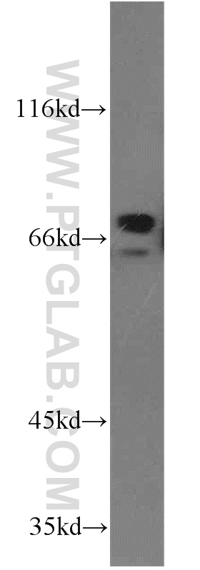 21843-1-AP;Jurkat cells