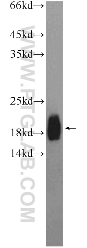 19901-1-AP;PC-3 cells