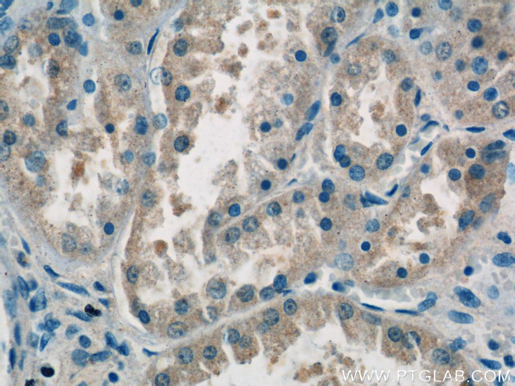 15827-1-AP;human kidney tissue