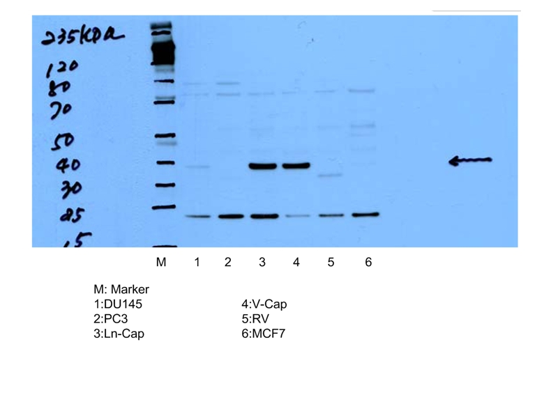 15918-1-AP;multi-cells