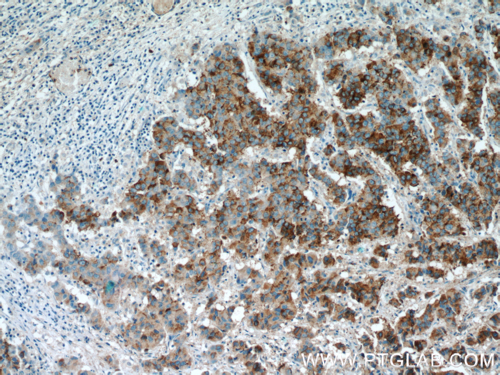 15918-1-AP;human prostate cancer tissue