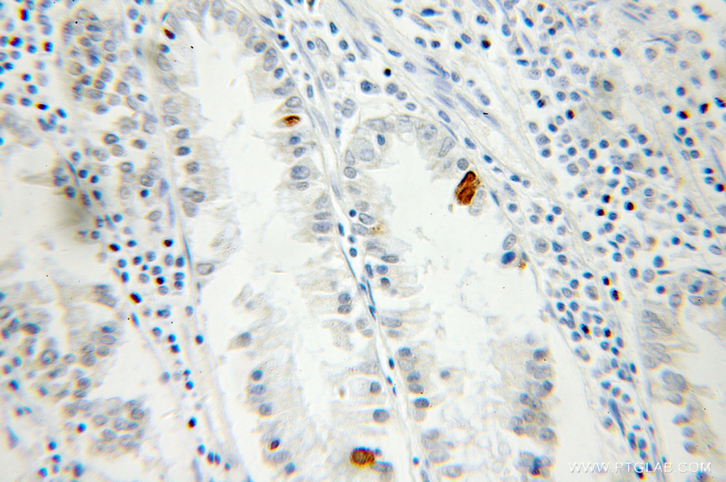 DNAJB6 Antibody 11707 1 AP Proteintech