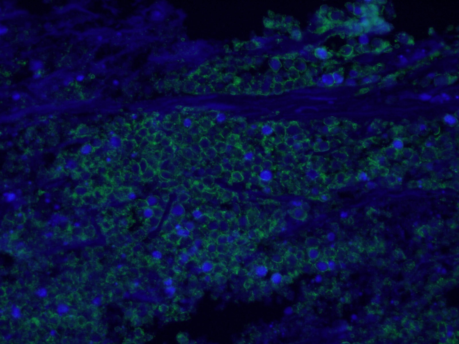 Epcam Cd Antibody Ap Proteintech