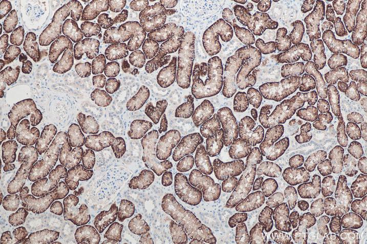 使用 Proteintech 的 SLC13A3 兔多克隆抗体 (26184-1-AP) 和抗兔自主全应用免疫组化试剂盒 (PK10017) 对人肾脏组织进行免疫组织化学分析。