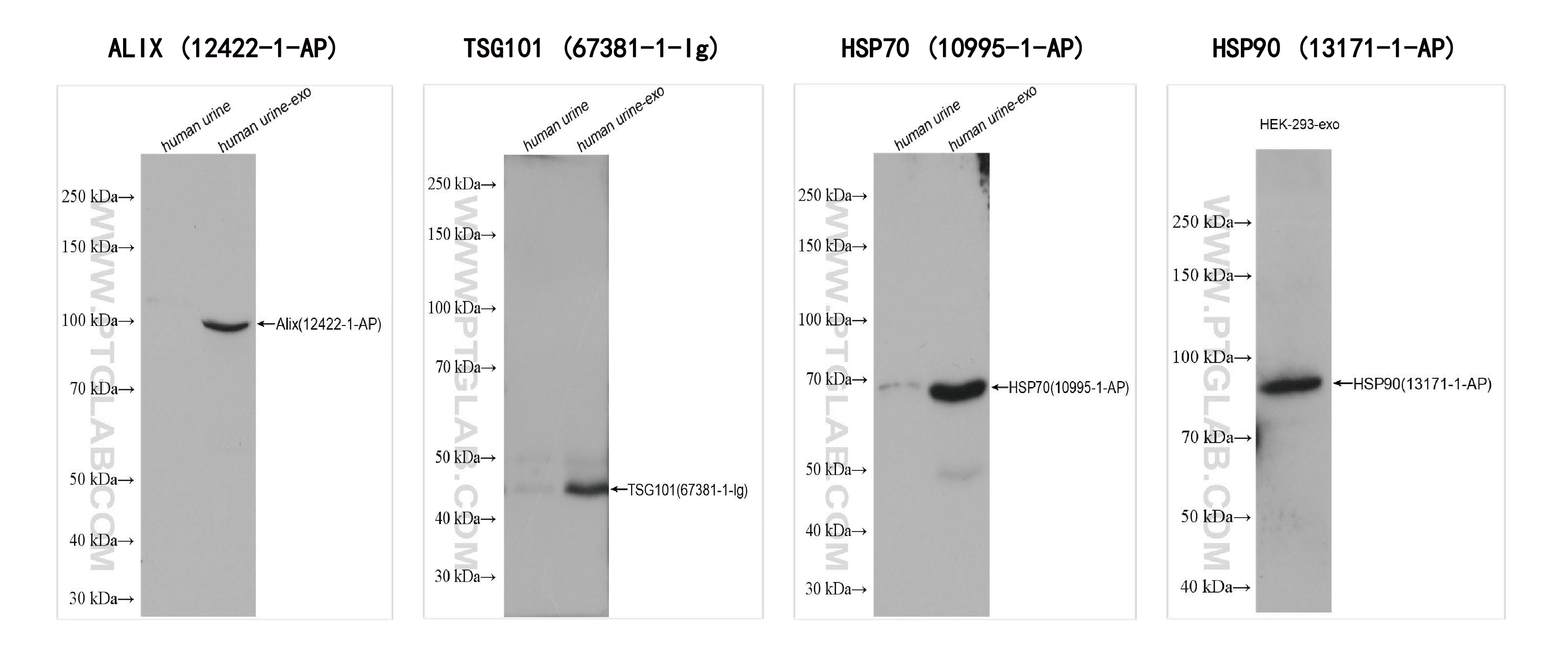 使用外泌体分离及蛋白提取试剂盒（细胞培养上清/尿液）（货号：PK10028）提取的human urine-derived exosomes (human urine-exo)和HEK-293-derived exosomes (HEK-293-exo)外泌体内蛋白检测。
<br>抗体：
<br>Alix          12422-1-AP  稀释度：1:10000;
<br>TSG101   67381-1-Ig  稀释度：1: 5000;
<br>HSP70     10995-1-AP  稀释度：1: 10000;
<br>HSP90     13171-1-AP 稀释度：1:10000。