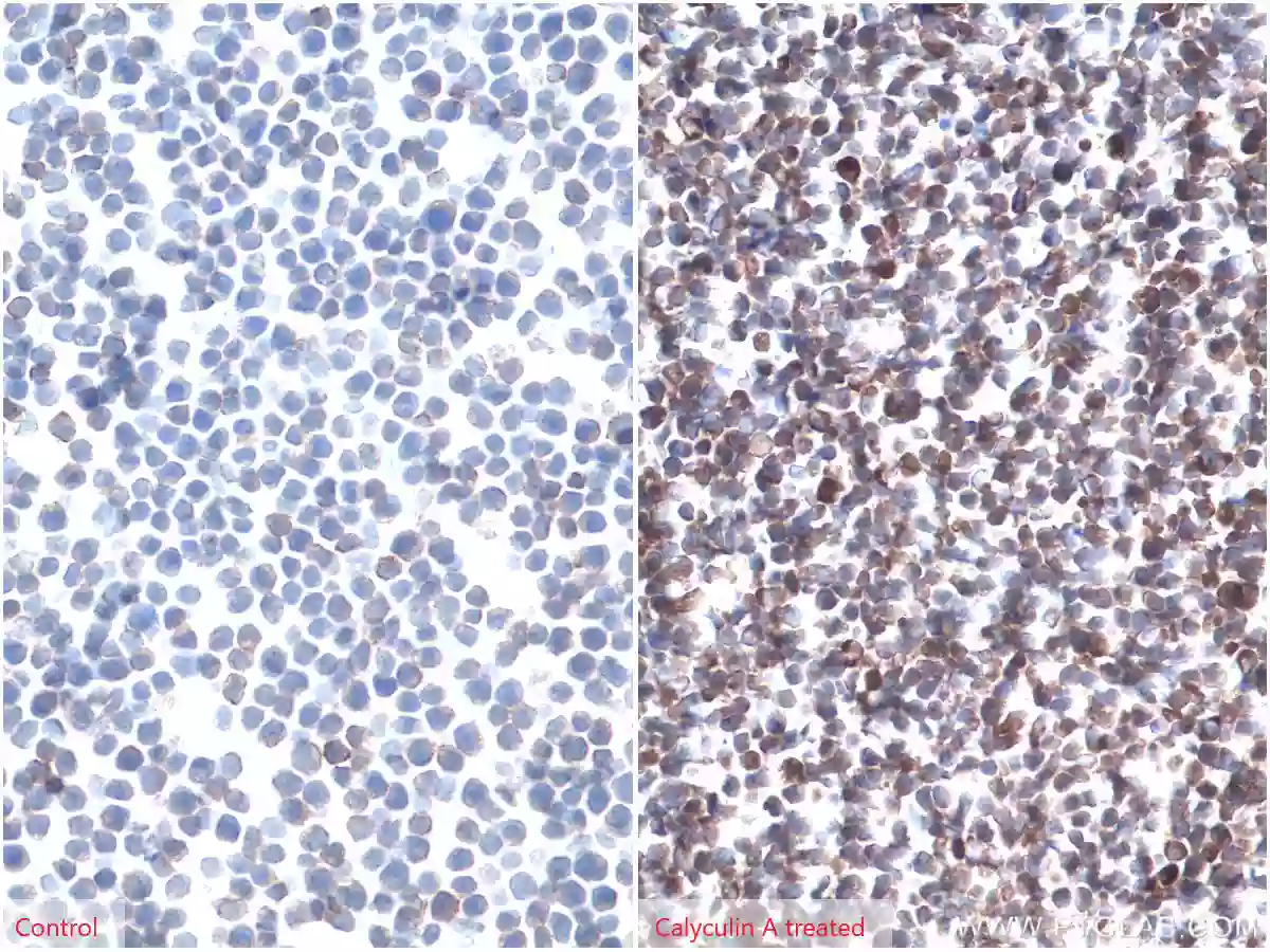 Immunohistochemistry analysis of paraffin-embedded untreated (left) or calyculin A treated (right) Jurkat cells slide using Phospho-AKT (Ser473) antibody (66444-1-Ig) at a dilution of 1:8000 (under 40x lens)