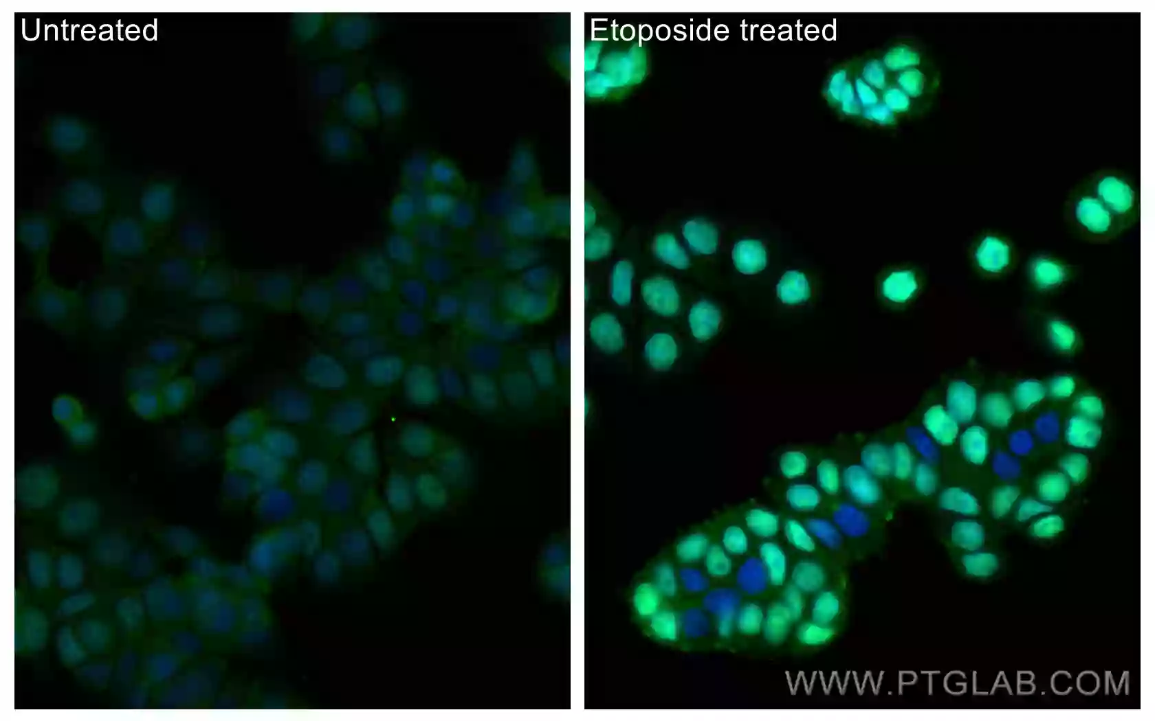 Immunofluorescent (IF) analysis of fixed etoposide treated HT-29 cells using CoraLite Plus 488 Phospho-P53 (Ser15) Recombinant Antibody