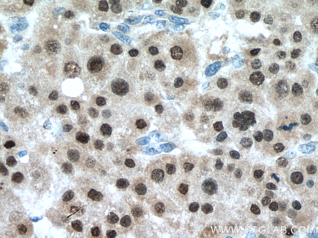 HNF1B Antibody 12533-1-AP | Proteintech