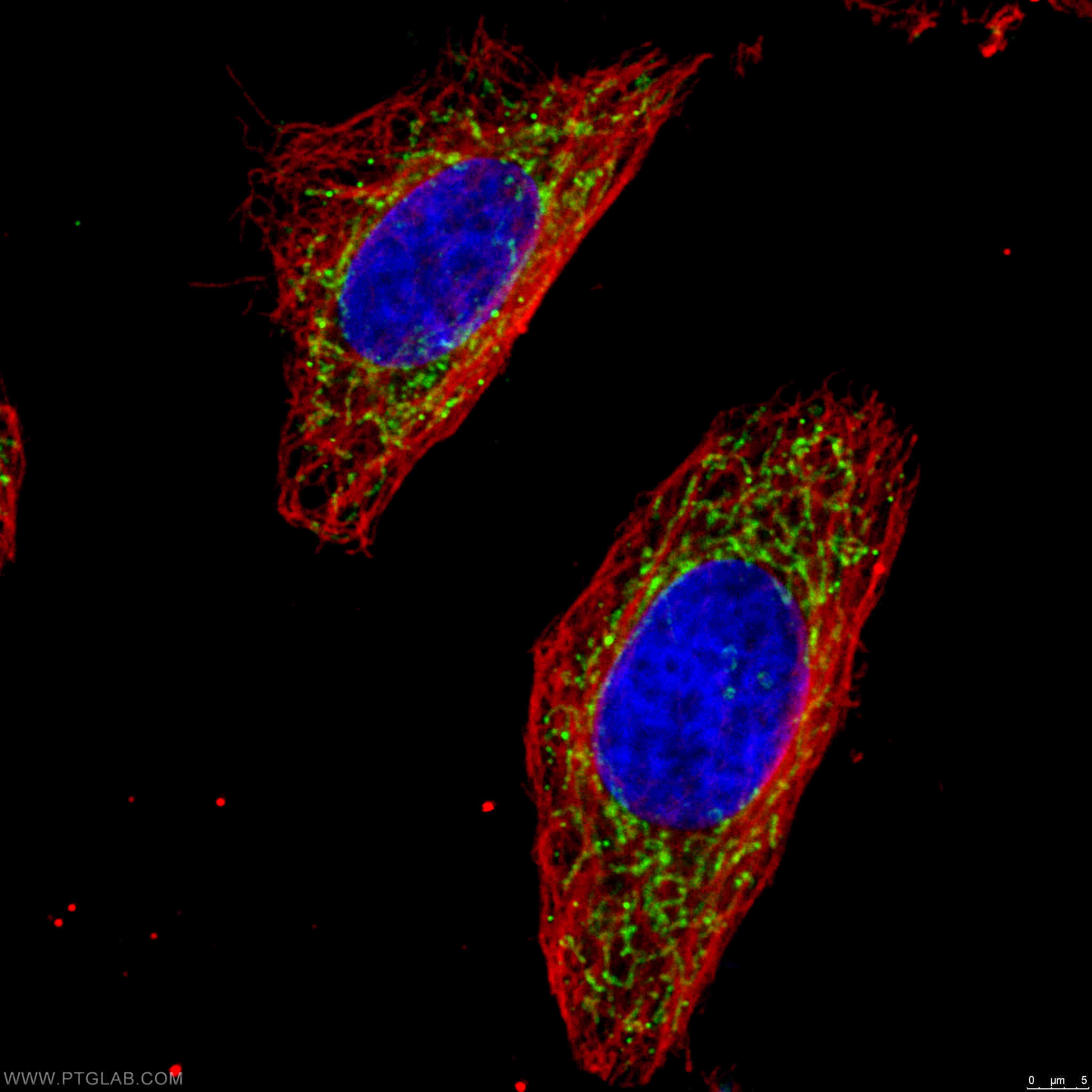 IF staining of HeLa cells using 15212-1-AP