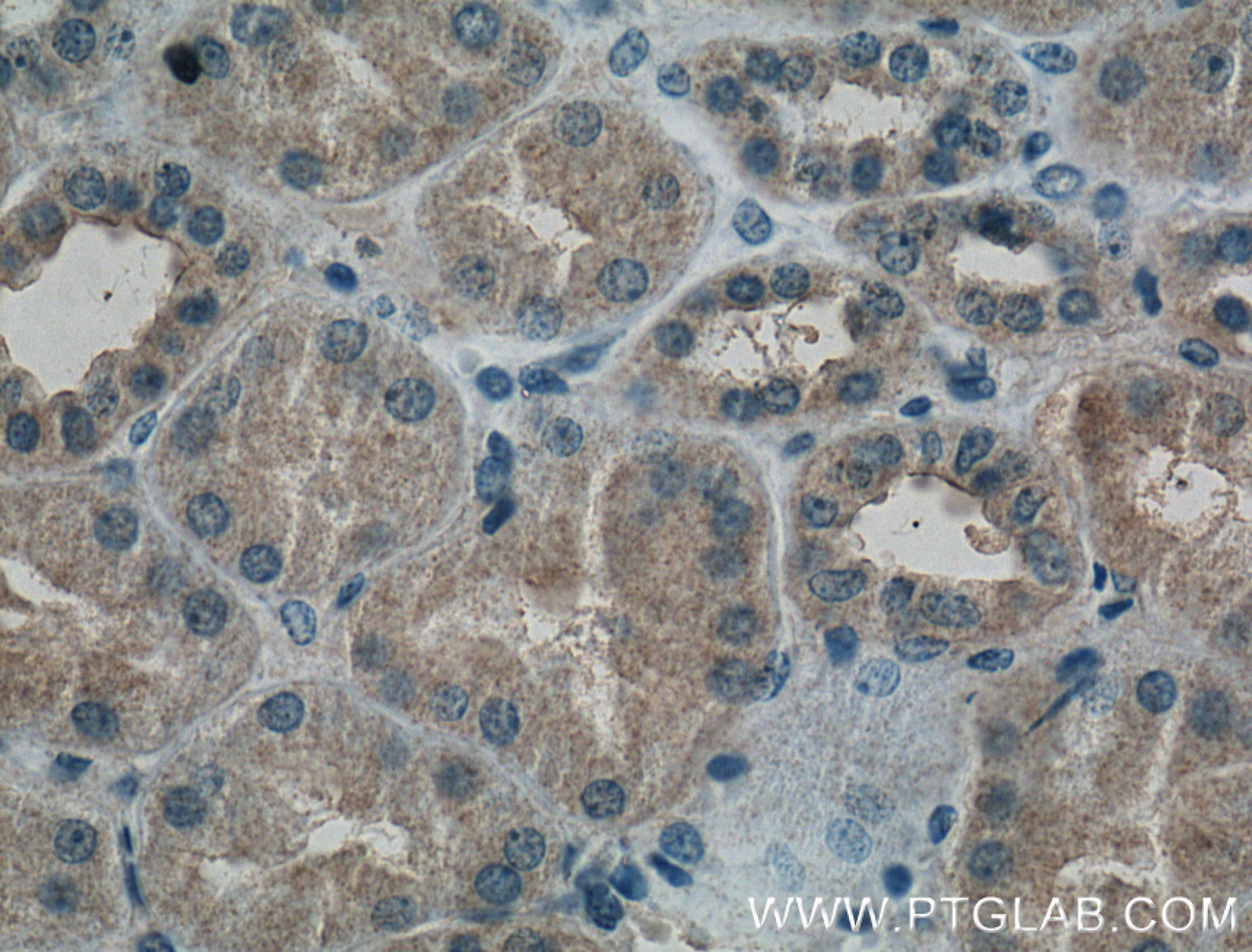 PAI-1 Antibody 66261-1-Ig | Proteintech