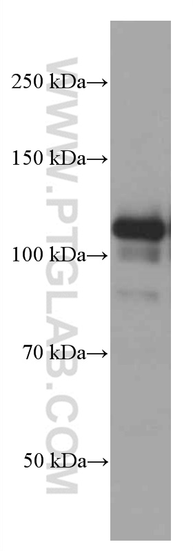 Parp1 Antibody 665 1 Ig Proteintech