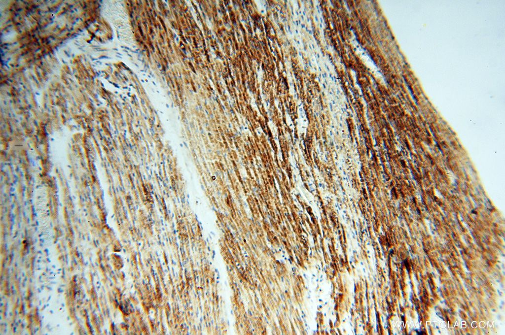 PDH E1 Alpha Antibody 18068-1-AP | Proteintech