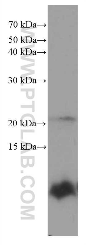 S100 Beta Antibody 1 Ig Proteintech