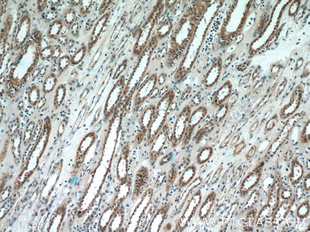 IHC staining of paraffin-embedded human kidney tissue slide using SCNN1A antibody (10924-2-AP) at a dilution of 1:50 (10x objective)