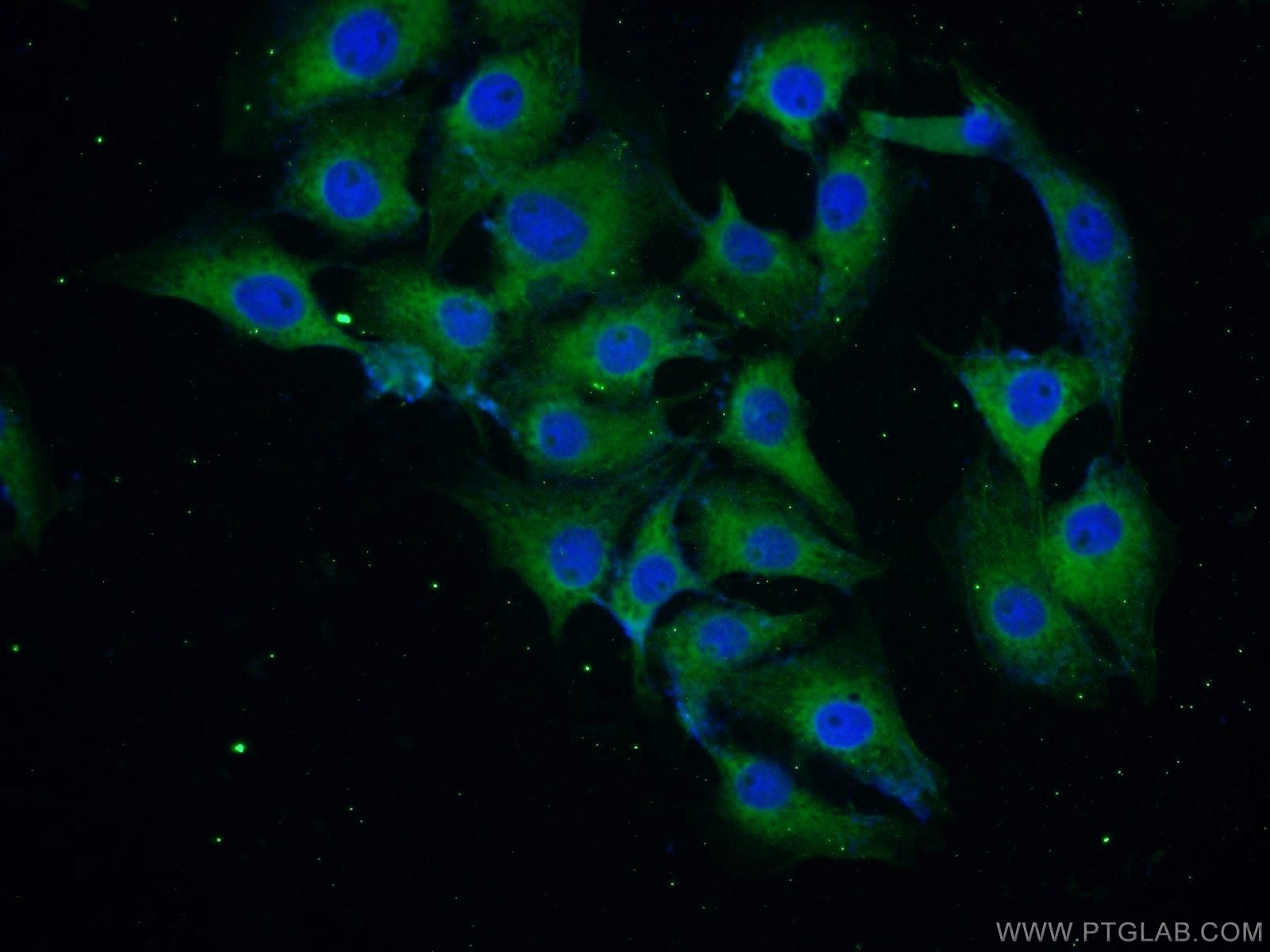 IF analysis of SH-SY5Y cells (human neuroblastoma) labeling Alpha-Synuclein with 10842-1-AP Proteintech antibody at a dilution of 1:25. Alexa Fluor 488-congugated AffiniPure Goat Anti-Rabbit IgG (H+L) was used as the secondary antibody and DAPI was used as the nuclear counterstain