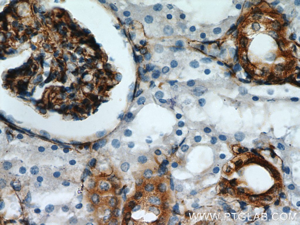 IHC staining of paraffin-embedded human kidney using Stanniocalcin 2 antibody (10314-1-AP) at a dilution of 1:50 (10x objective)