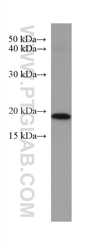 P21 Antibody 67362 1 Ig Proteintech 8435