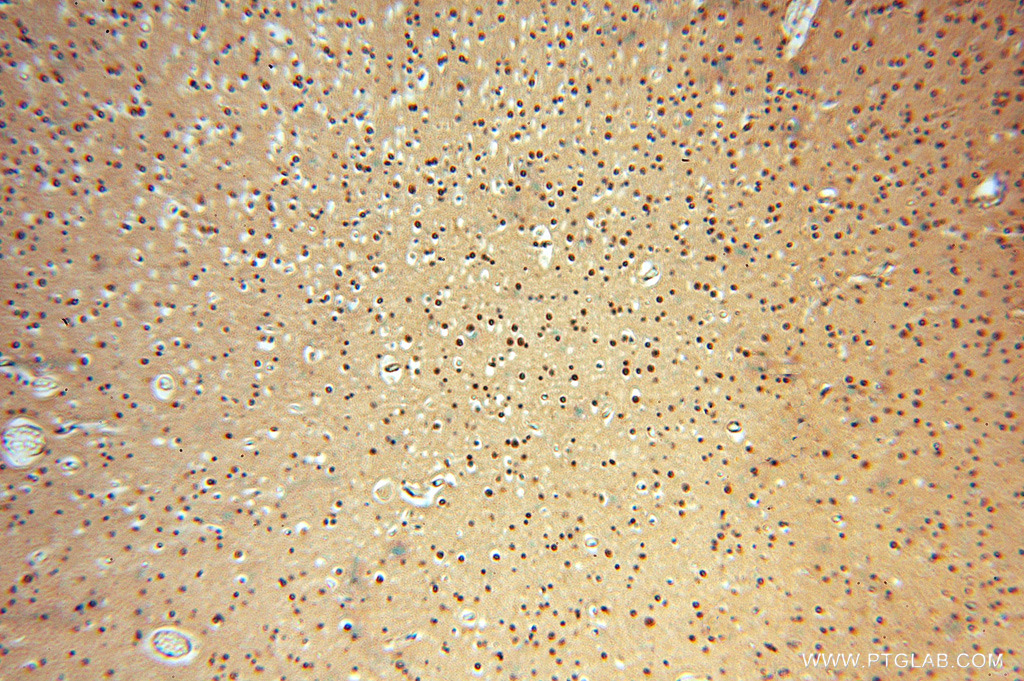 Immunohistochemical staining of paraffin-embedded human brain using SOD1 antibody