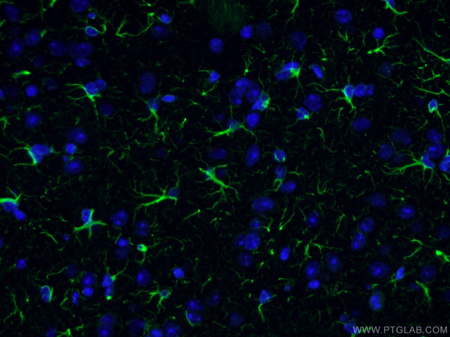 Immunofluorescent analysis of fixed mouse brain tissue using GFAP antibody