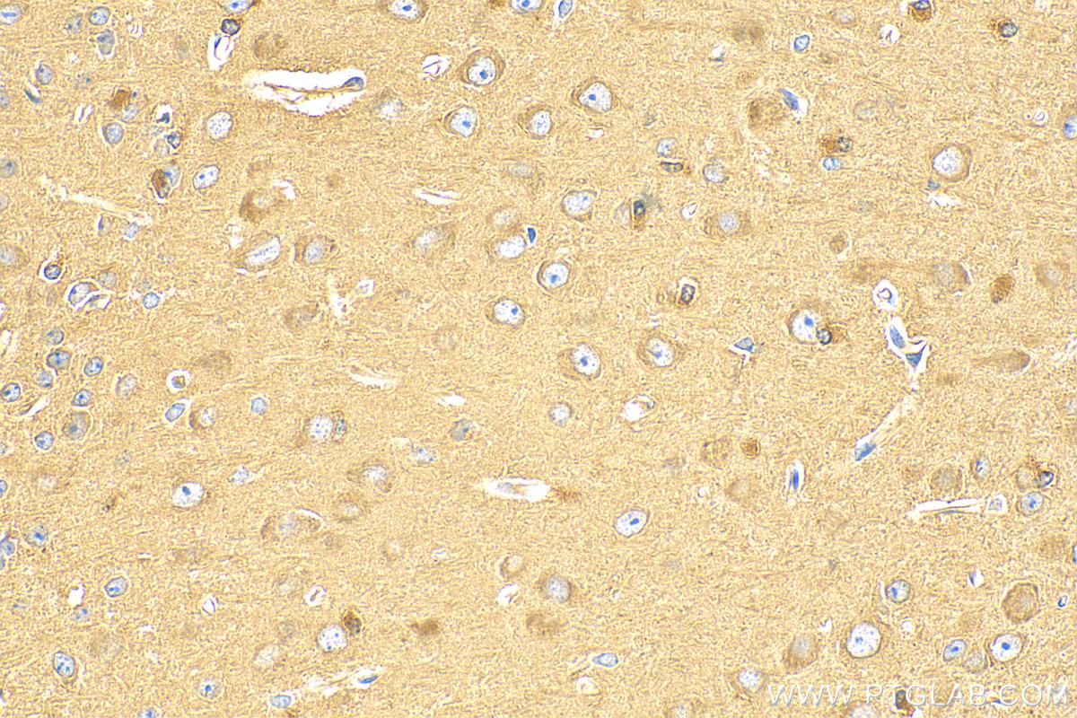 IHC staining of mouse brain using 14503-1-AP
