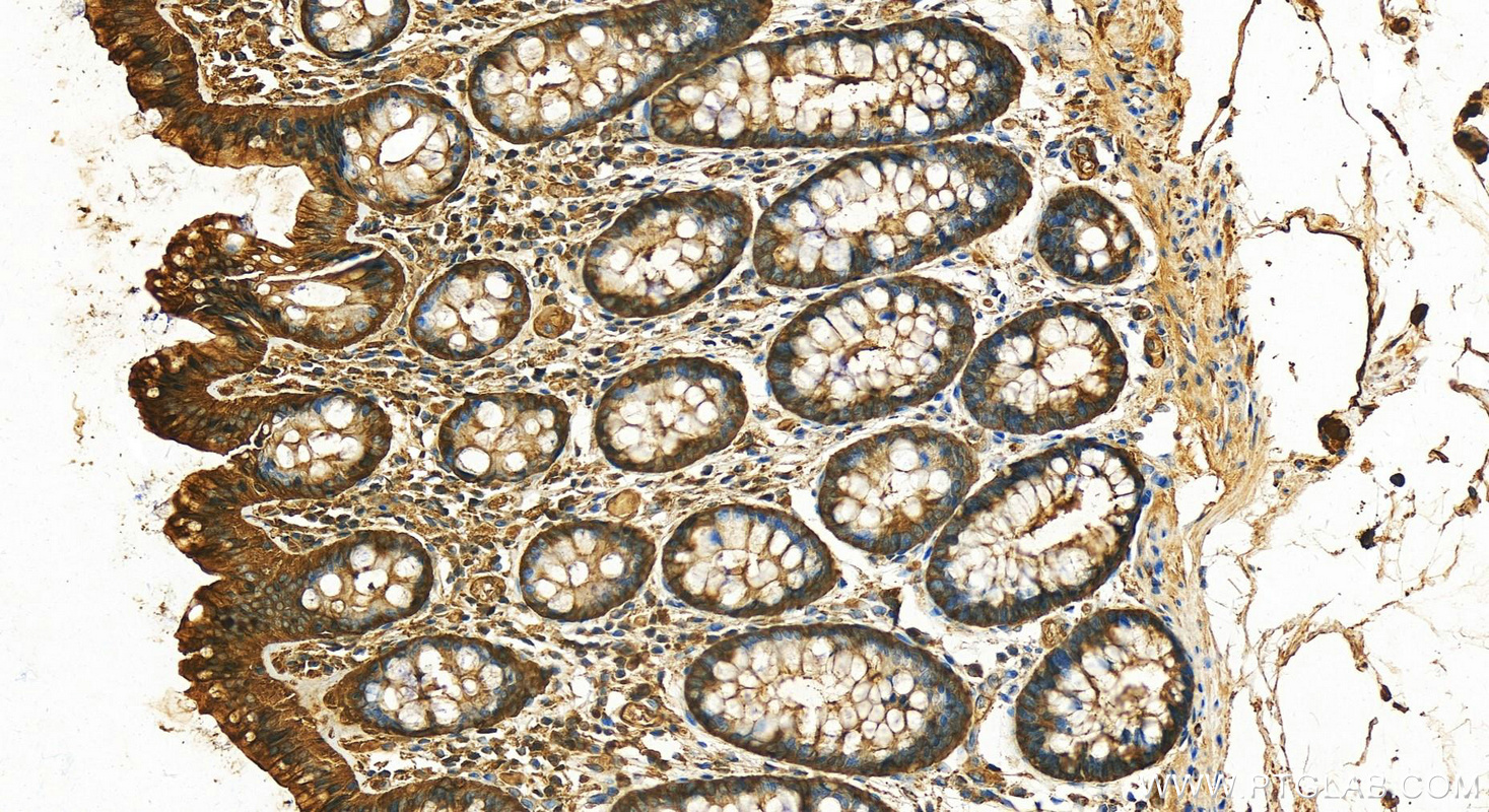 IHC staining of human colon using 11648-2-AP