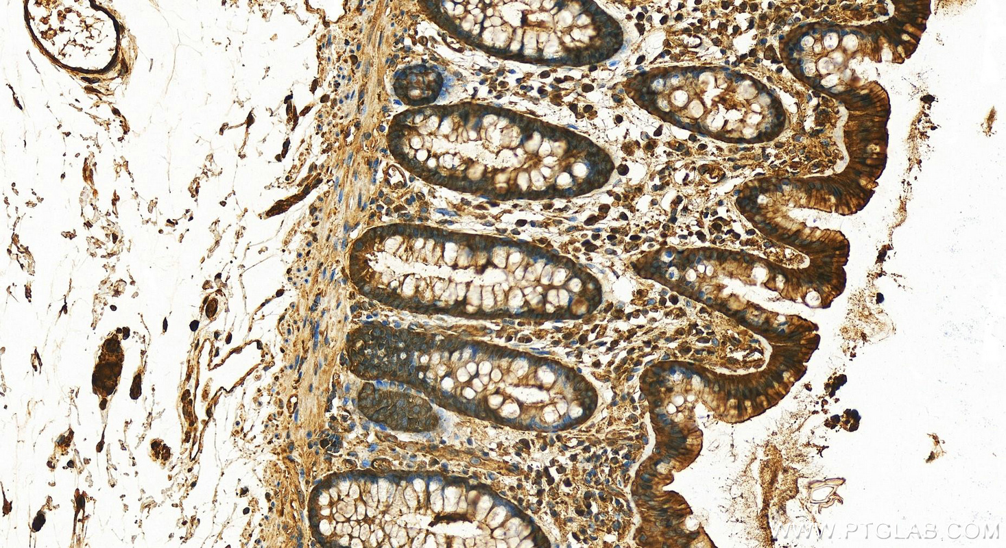 IHC staining of human colon using 11648-2-AP