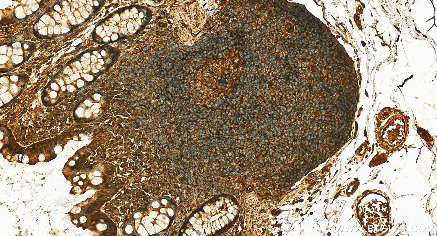 IHC staining of human normal colon using 11648-2-AP