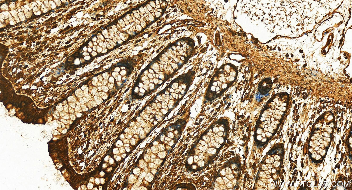 IHC staining of human normal colon using 11648-2-AP