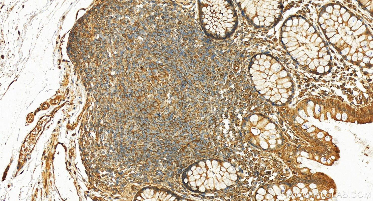 IHC staining of human normal colon using 12381-1-AP