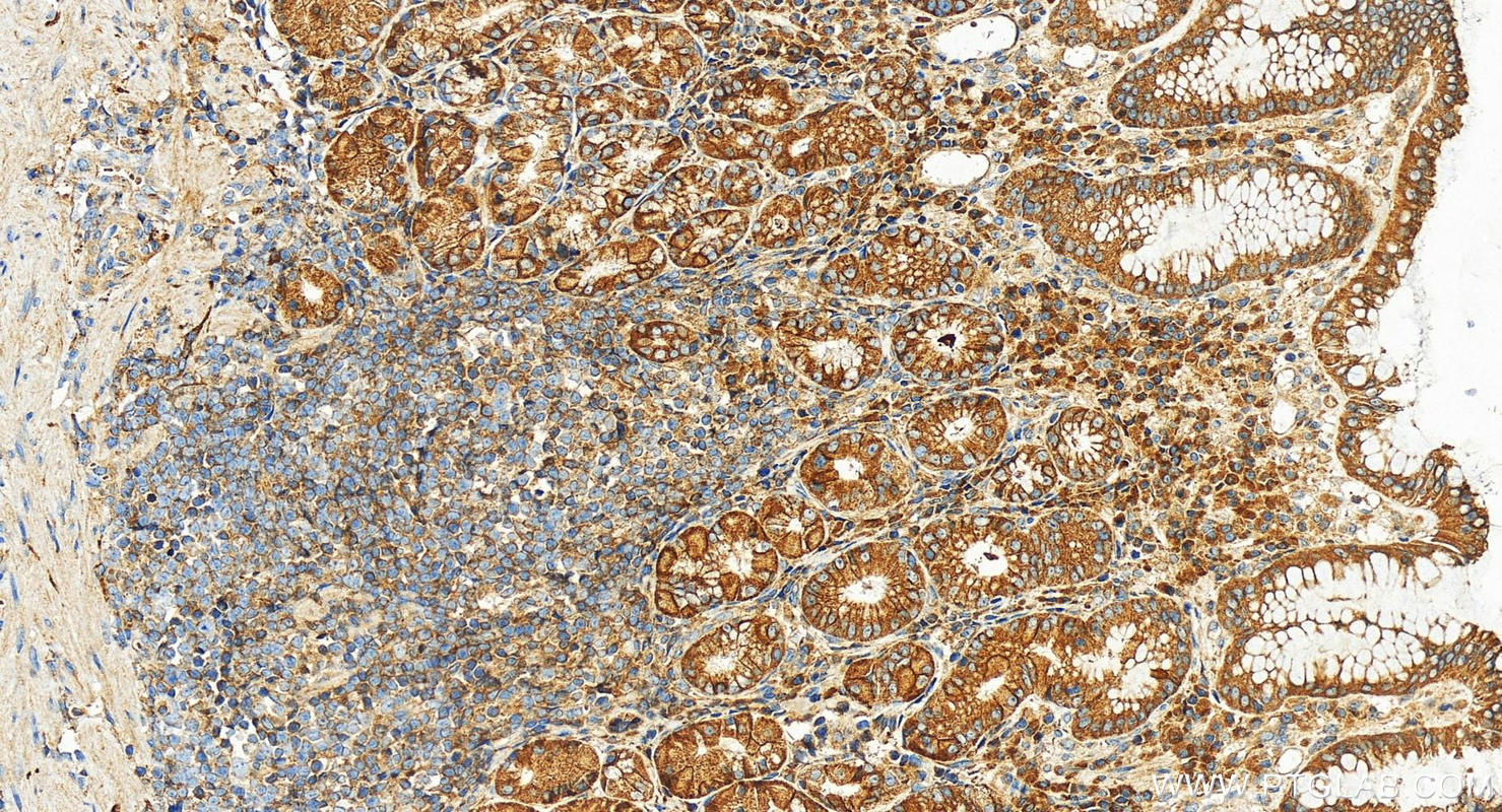 IHC staining of human stomach using 55163-1-AP