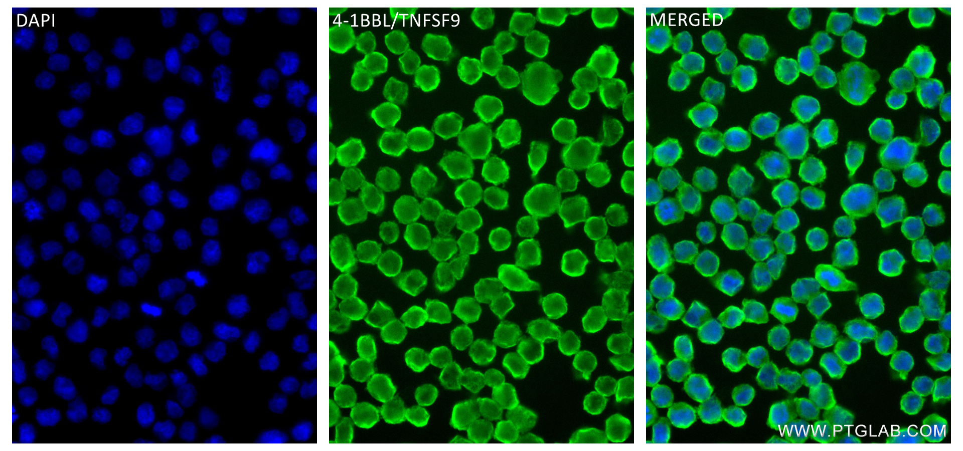 IF Staining of Raji using 84185-5-RR