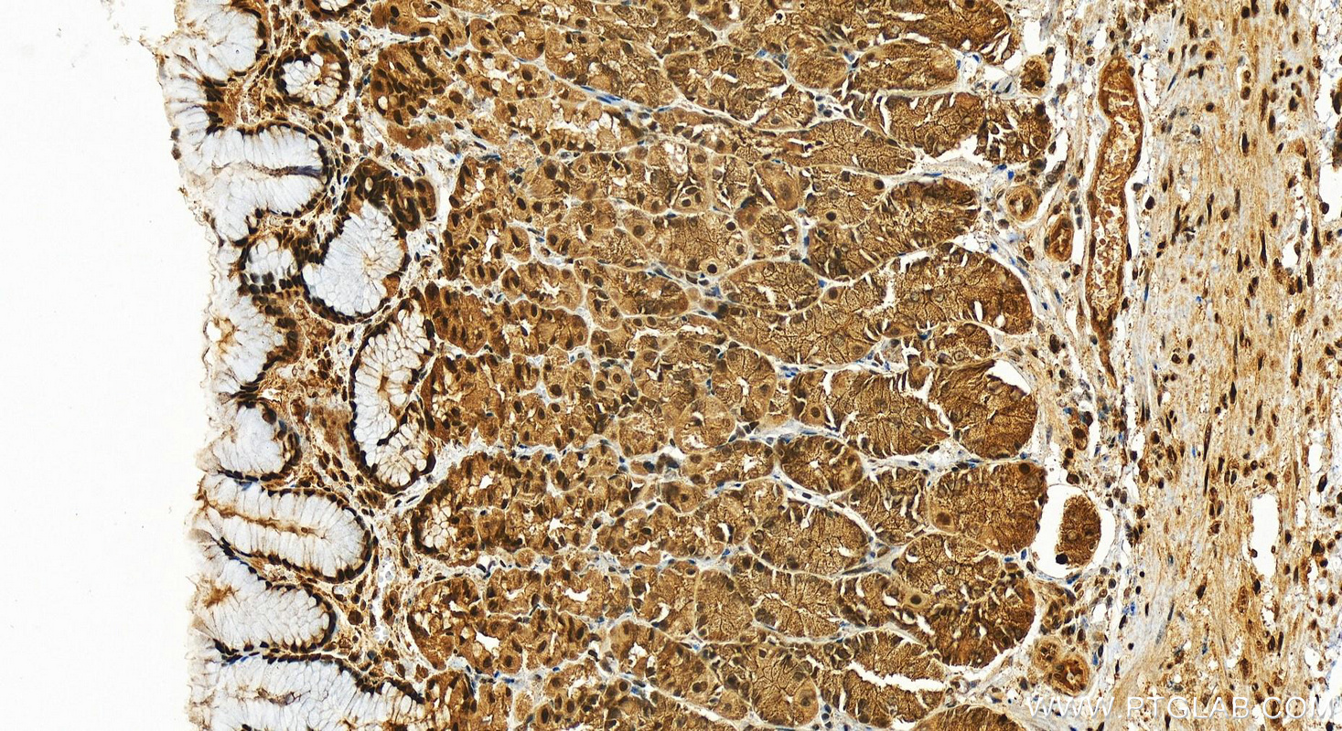 IHC staining of human stomach using 13988-1-AP