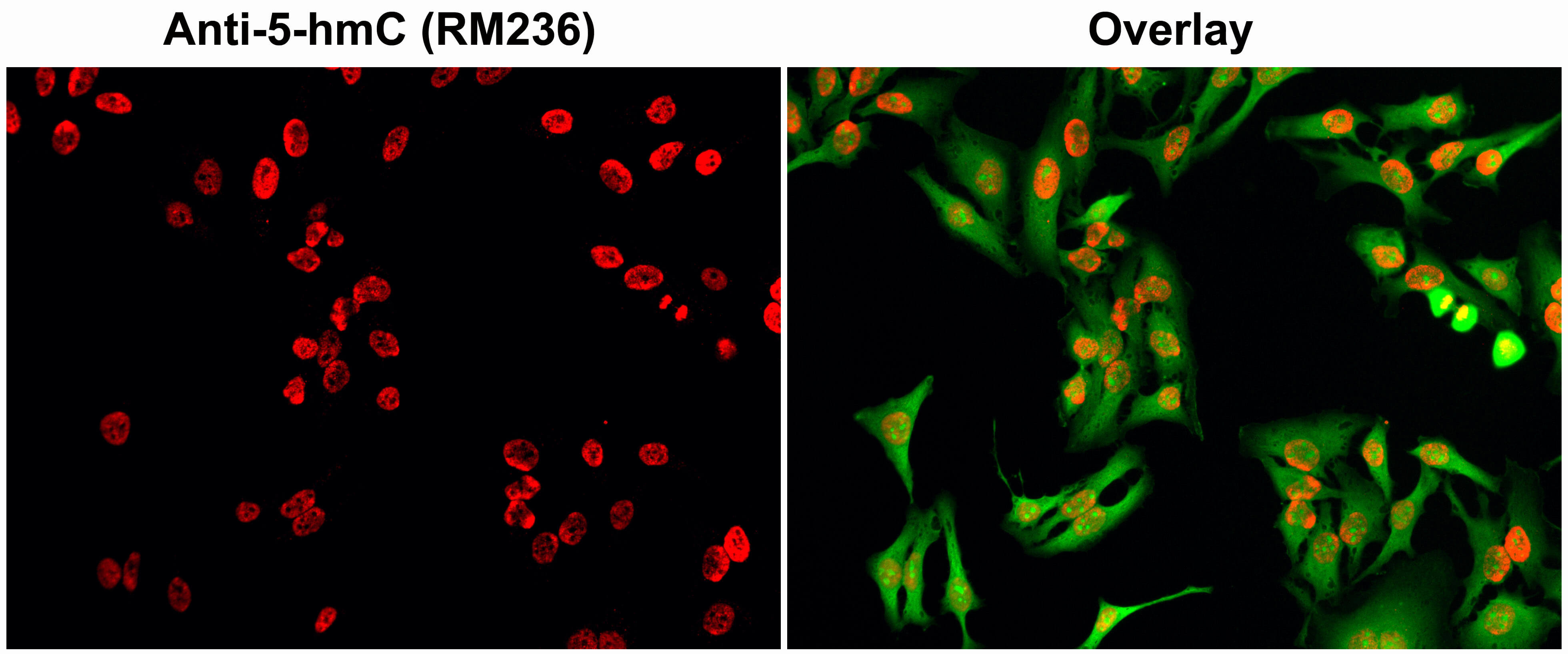 Immunofluoresence staining of HeLa cells using 5-Hydroxymethylcytosine antibody (Clone RM236) at 0.5ug/mL (red). Actin filaments are labeled with fluorescein phalloidin (green). HeLa cells were fixed with 4% paraformaldehyde and permeabilized with methanol (−20°C) before treatment with 2 N HCl for 30 min at 37 °C to denature DNA.