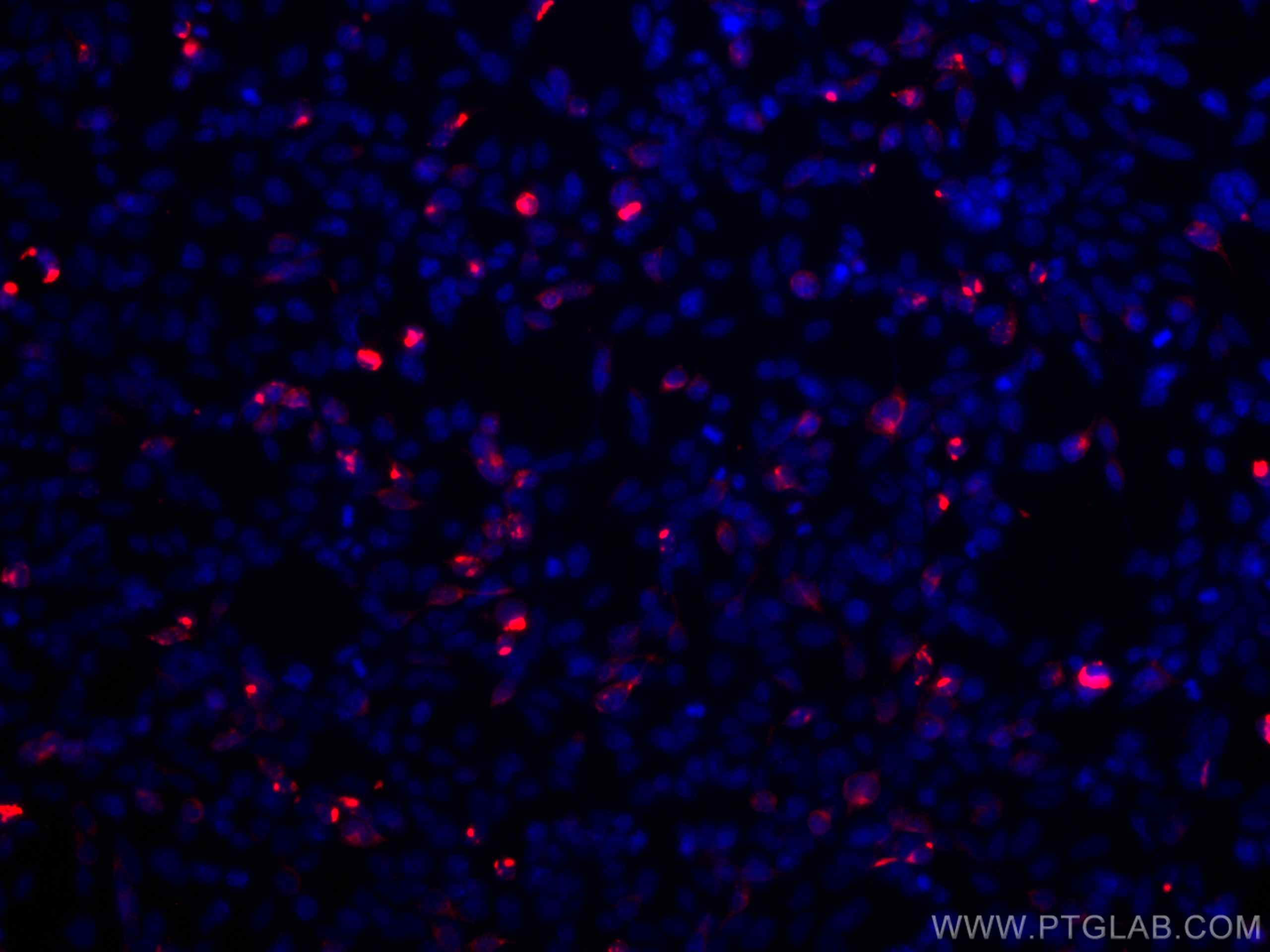 IF Staining of Transfected HEK-293 using CL594-66005