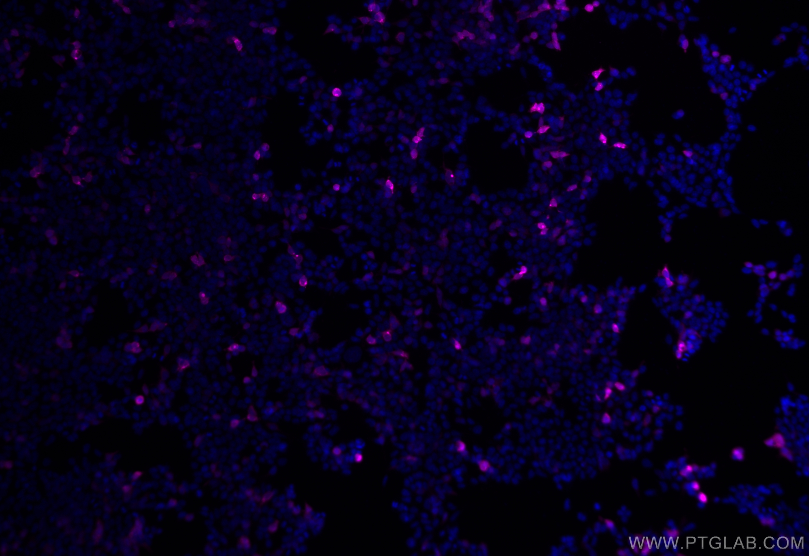 IF Staining of Transfected HEK-293 using APC-66005