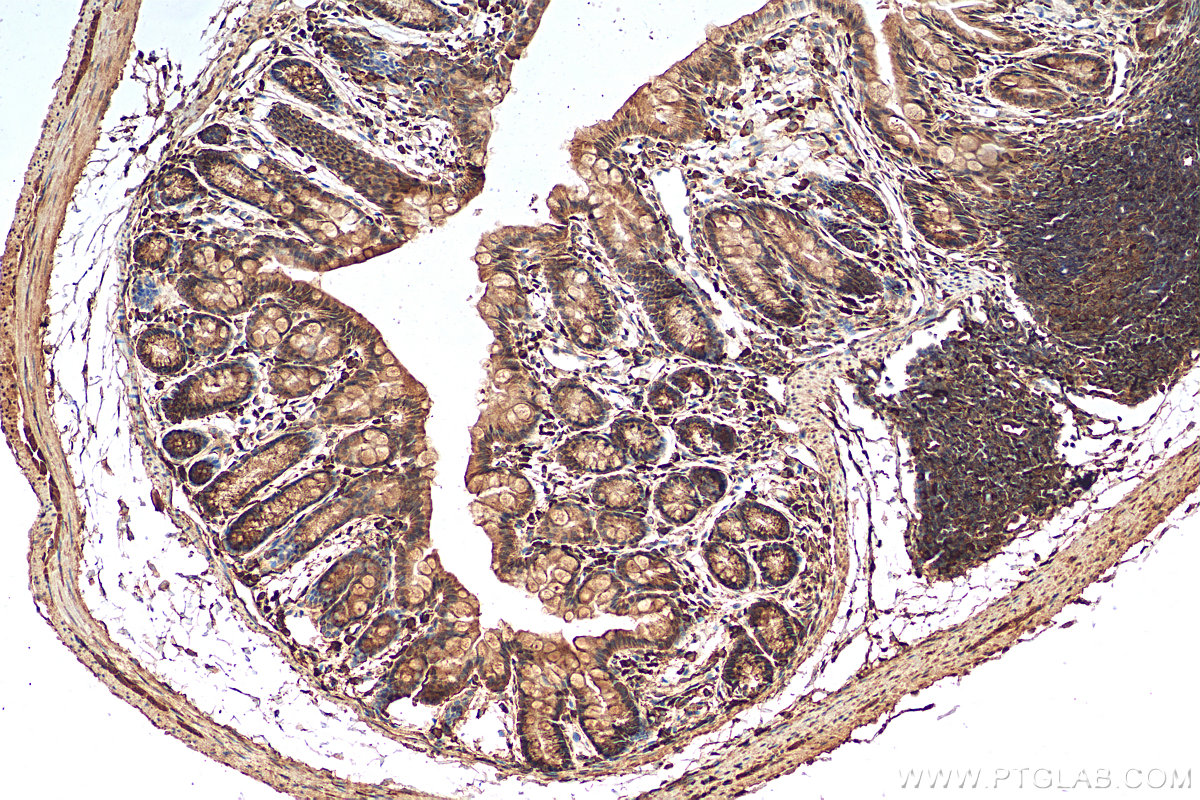 IHC staining of mouse colon using 25812-1-AP