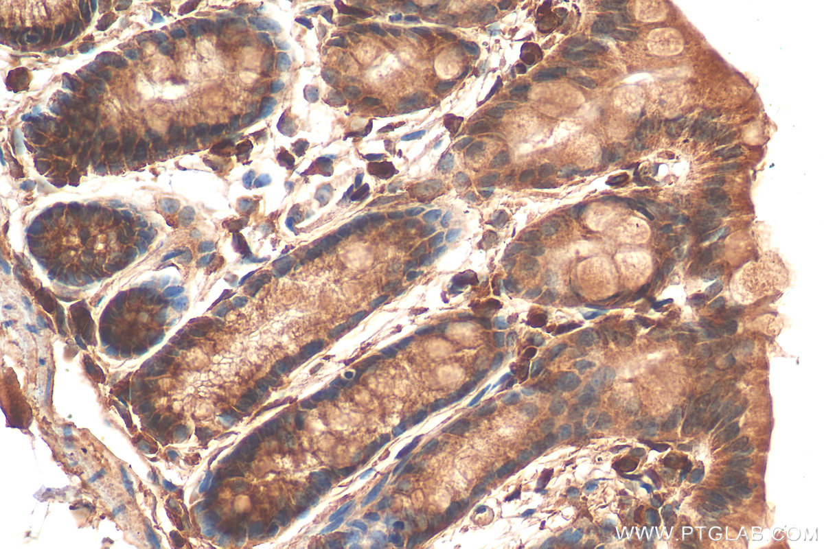 IHC staining of mouse colon using 25812-1-AP