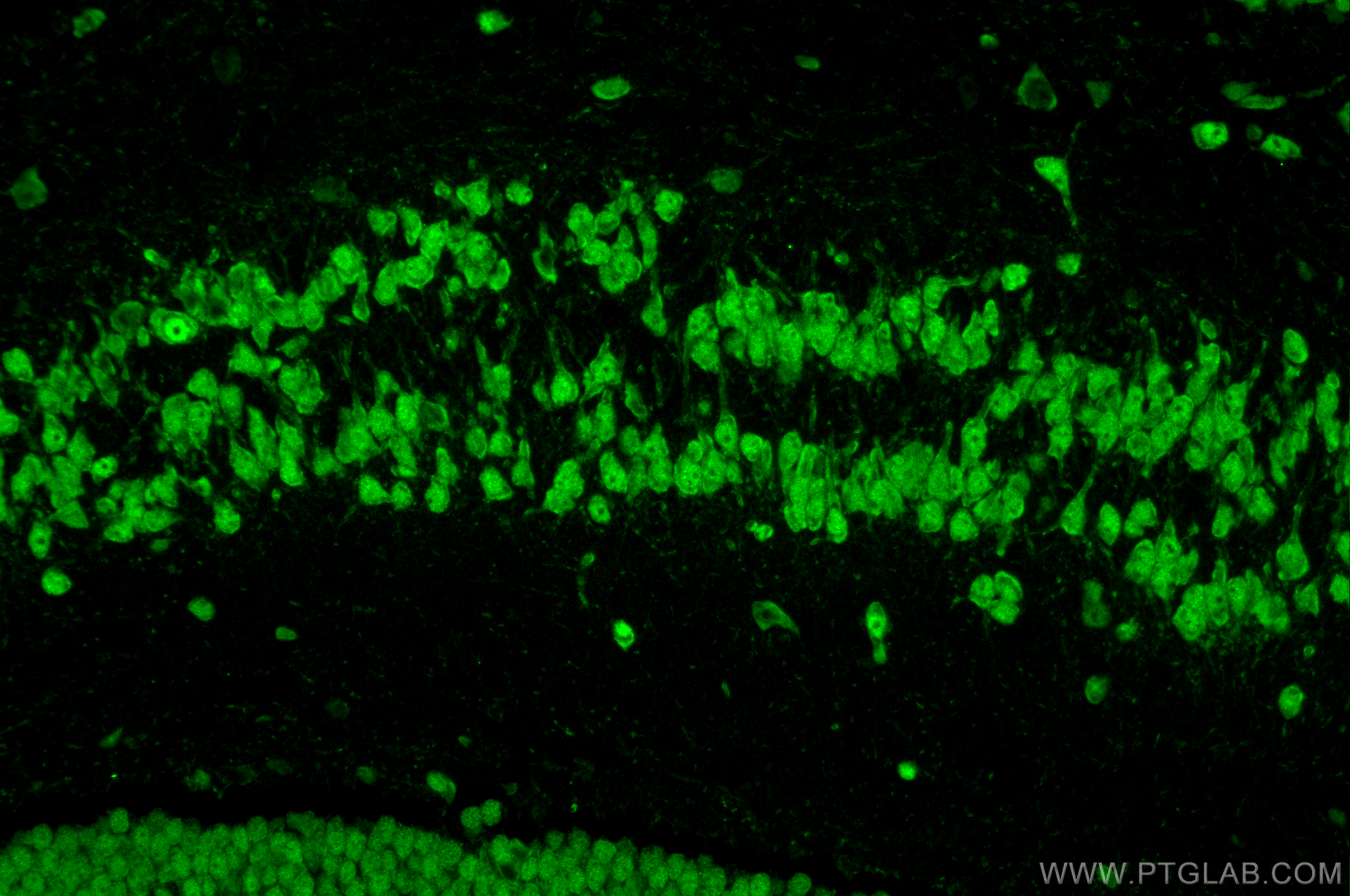 IF Staining of mouse brain using 22647-1-AP