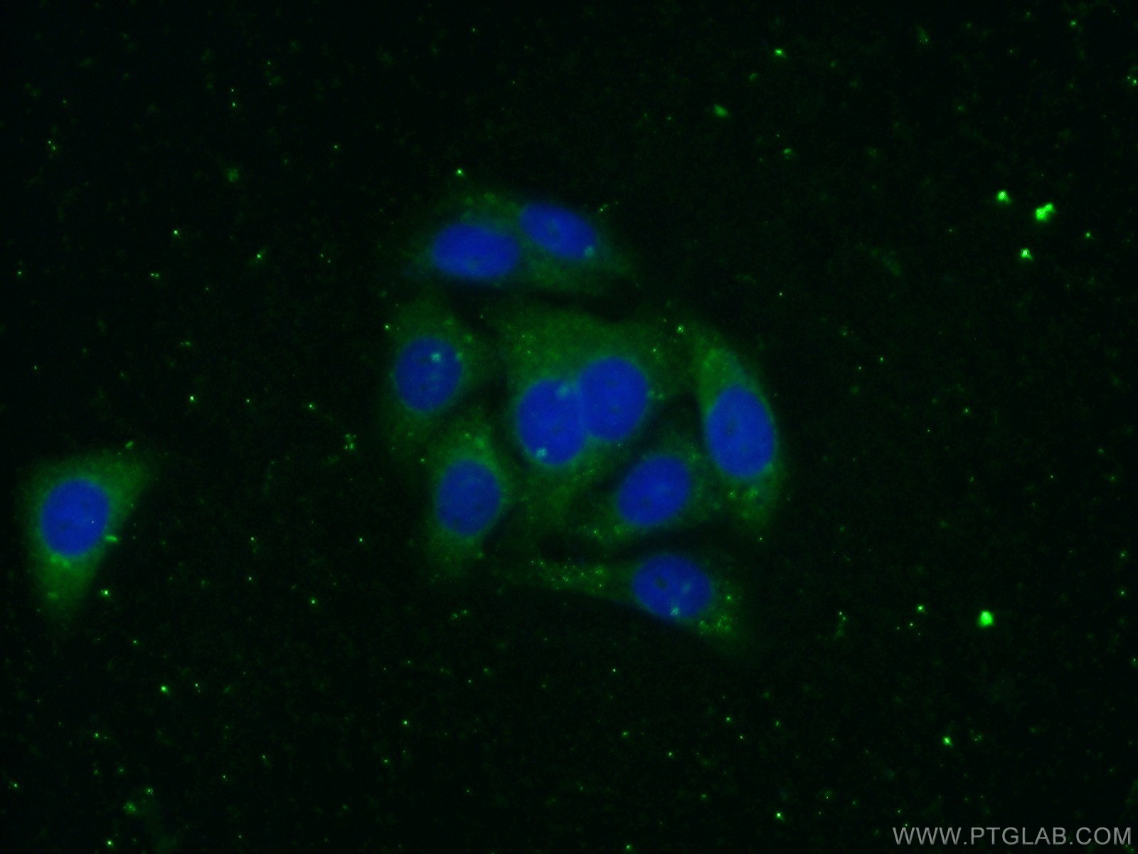 Alpha-2-Macroglobulin