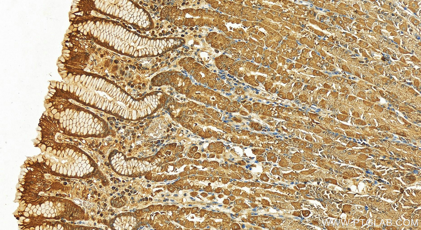 IHC staining of human stomach using 22670-1-AP