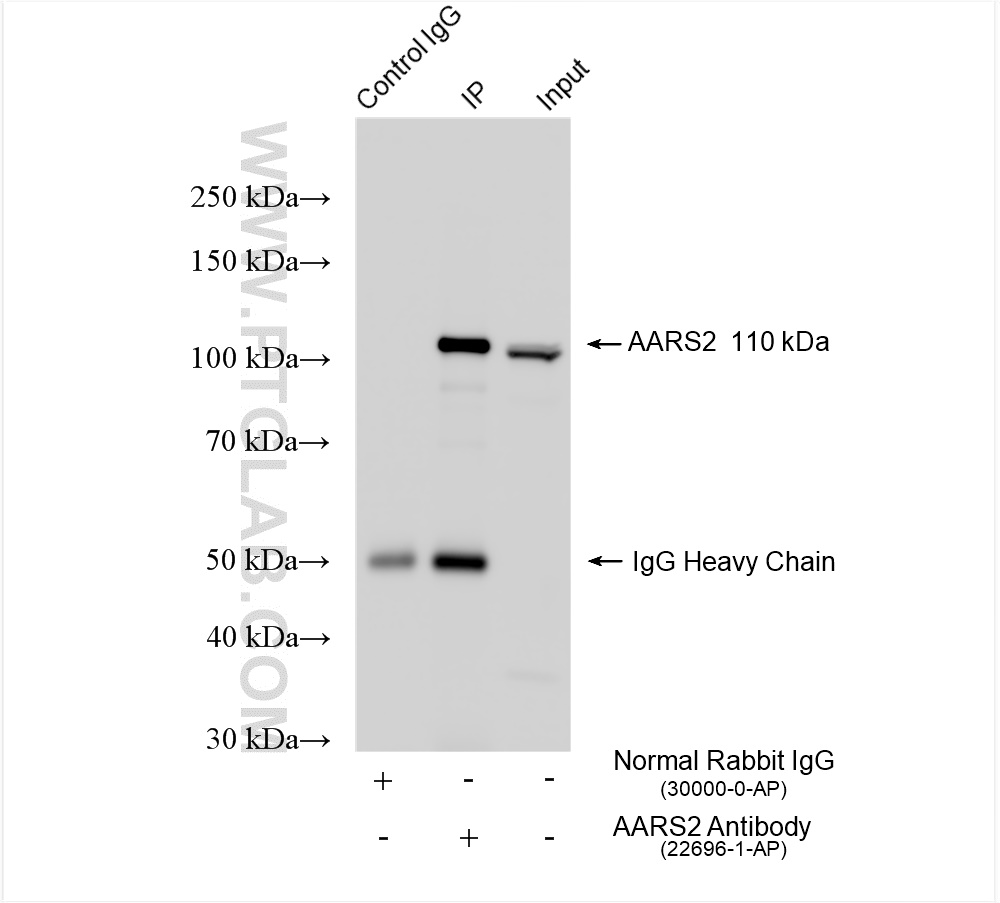 IP experiment of K-562 using 22696-1-AP