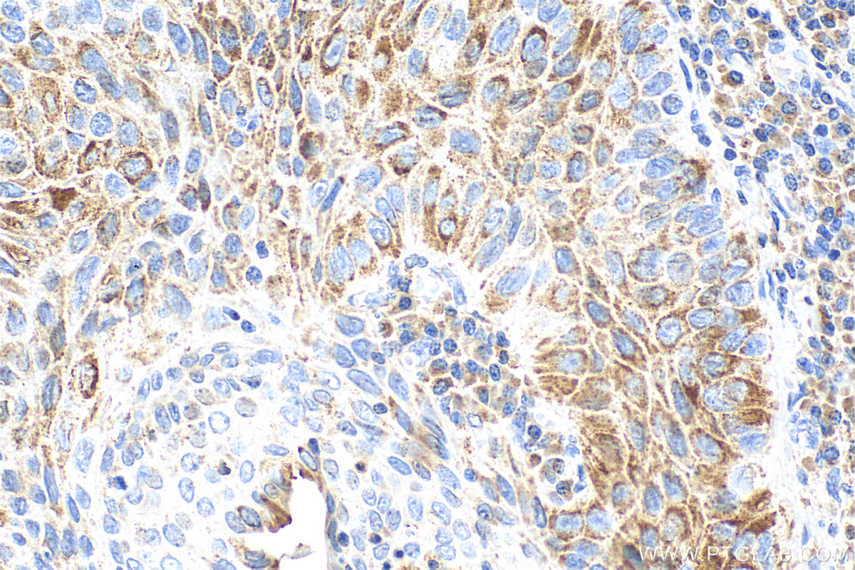 IHC staining of Customer Sample using 11349-1-AP