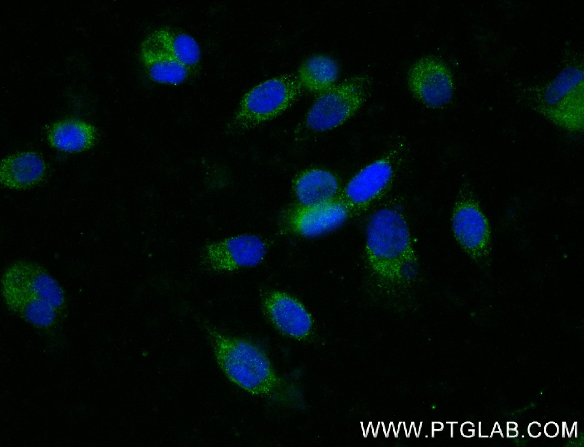 IF Staining of PC-3 using 84204-5-RR