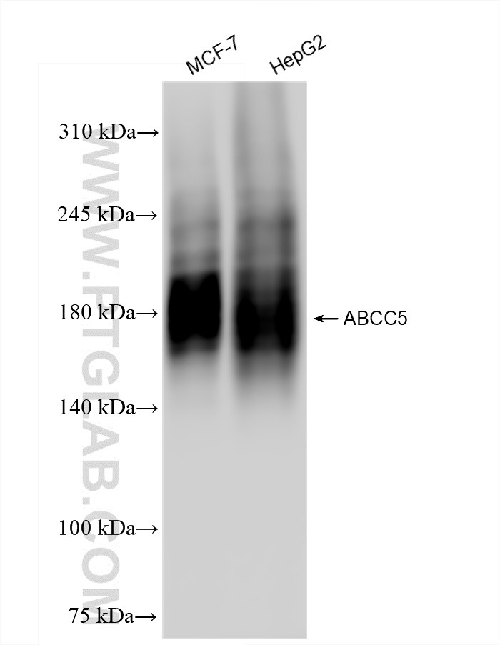 WB analysis using 84204-5-RR