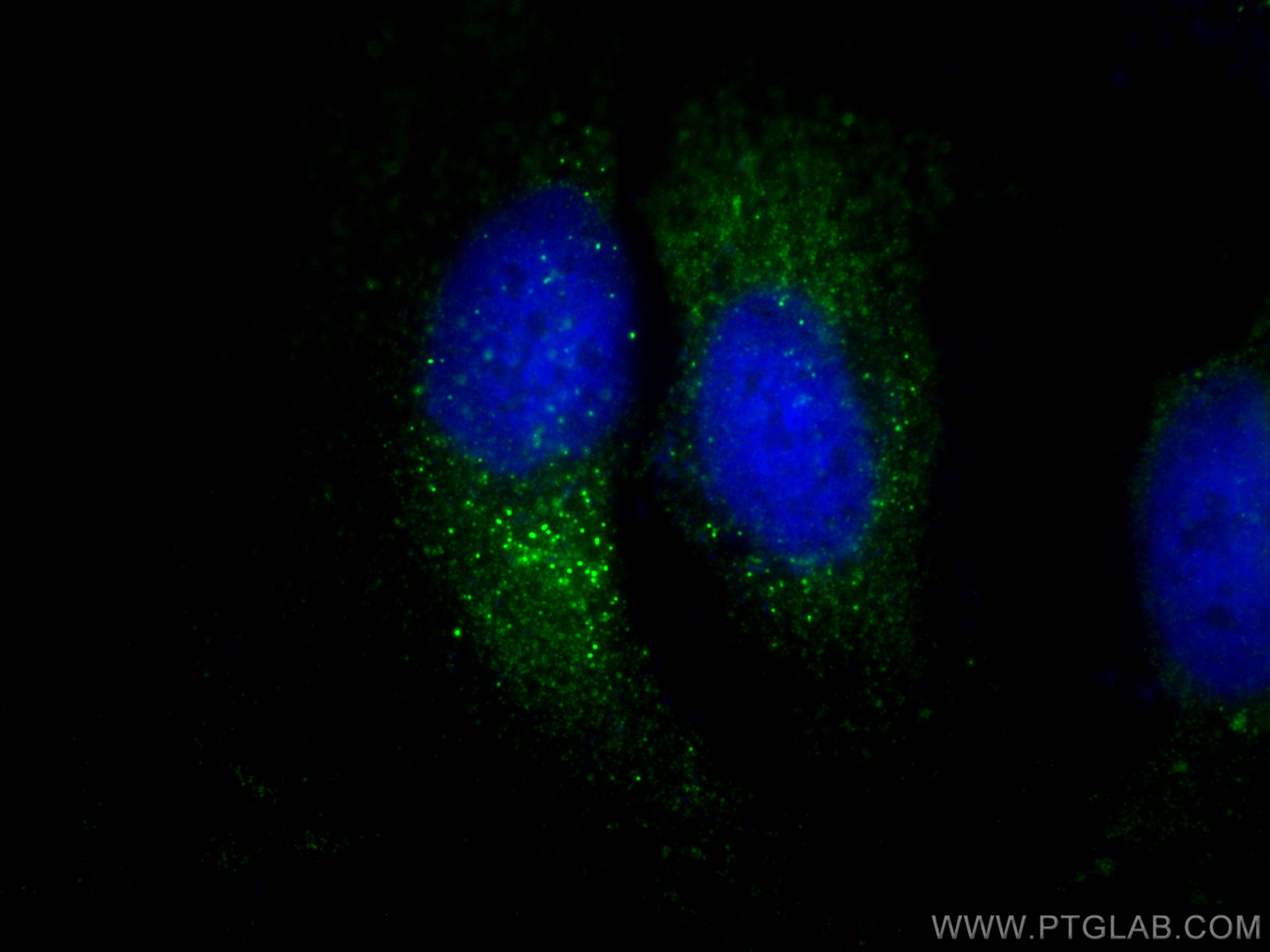 IF Staining of HeLa using 18138-1-AP