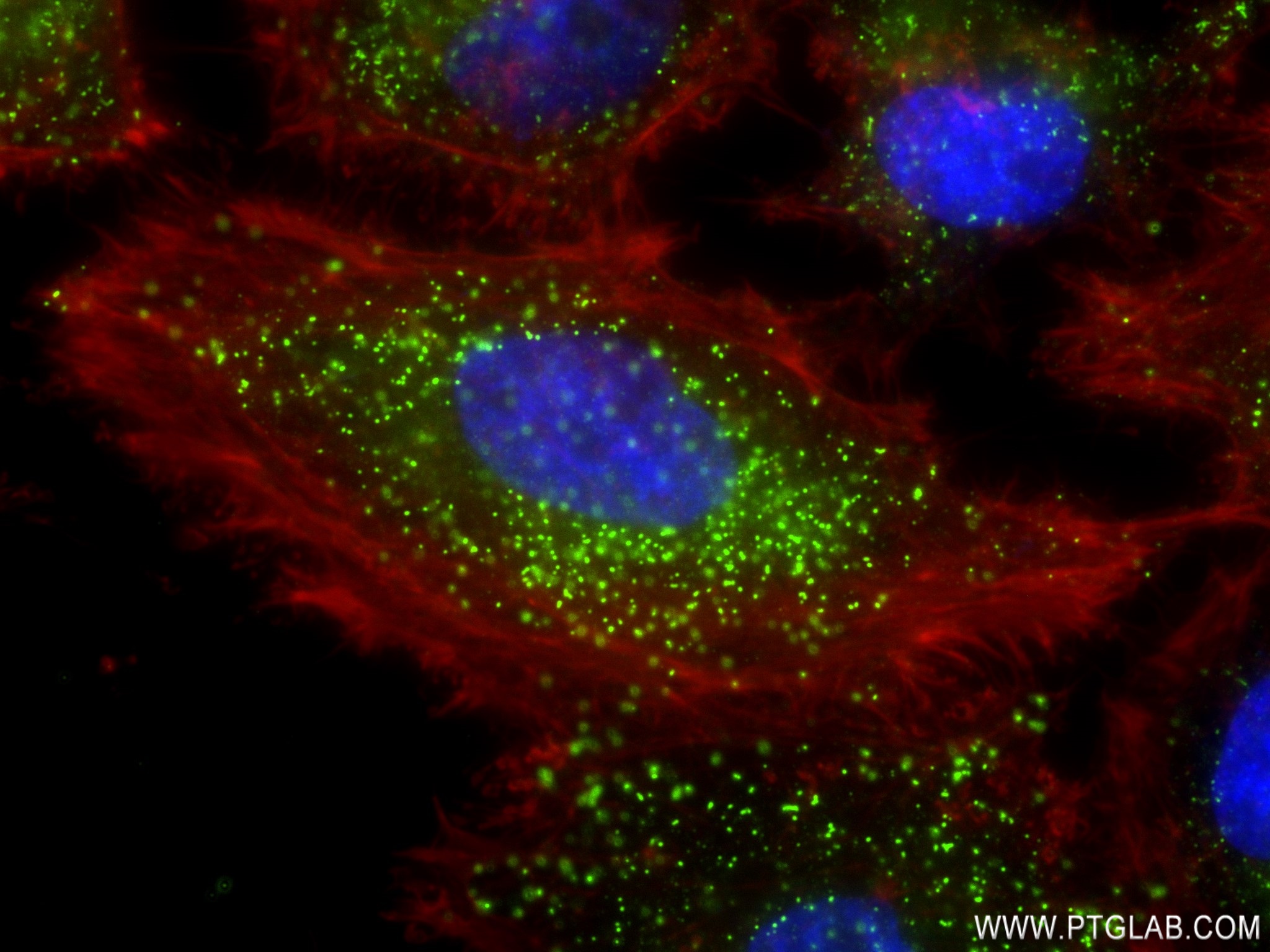 IF Staining of HeLa using 83038-4-RR (same clone as 83038-4-PBS)